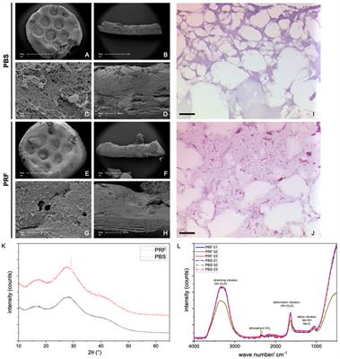 Towards optimized tissue regeneration: a new 3D printable bioink of alginate/cellulose hydrogel loaded with thrombocyte concentrate